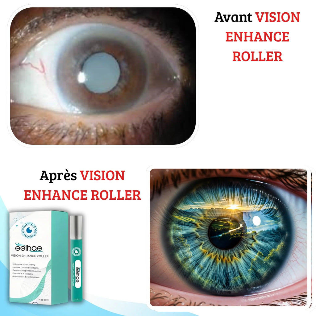ROULEAU D'AMÉLIORATION DE VISION CLAIRE - GUÉRIR TOUTES MAUX D'YEUX